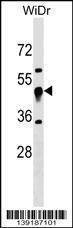 Anti-UQCRC1 (N-term) Antibody