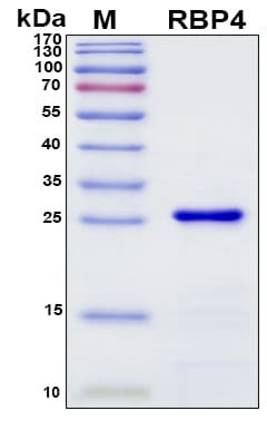 Recombinant Human Retinol-binding Protein 4