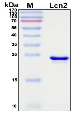 Recombinant Rat Lipocalin-2 Protein