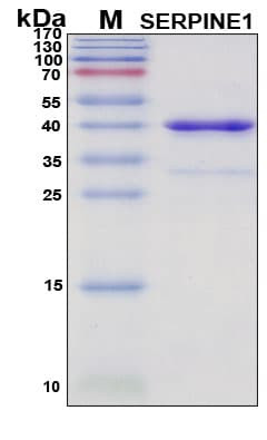Recombinant Porcine Serpin E1 Protein, Antigen Grade