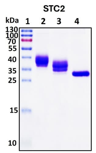 Recombinant Human Stanniocalcin 2 Protein
