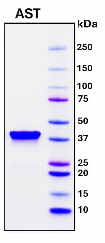 Recombinant Pig Aspartate Aminotransferase (AST) Protein
