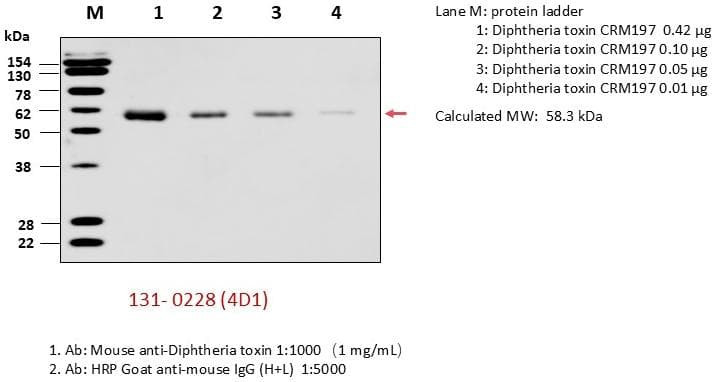 Anti-Diphtheria Toxin