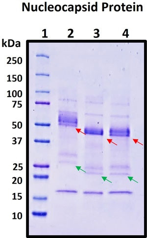 Recombinant SARS-CoV-2 Omicron Variant B.1.1.529 Nucleocapsid (N) Protein, Biotinylated