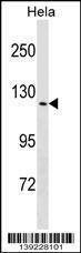 Anti-TRPV4 (N-term) Antibody