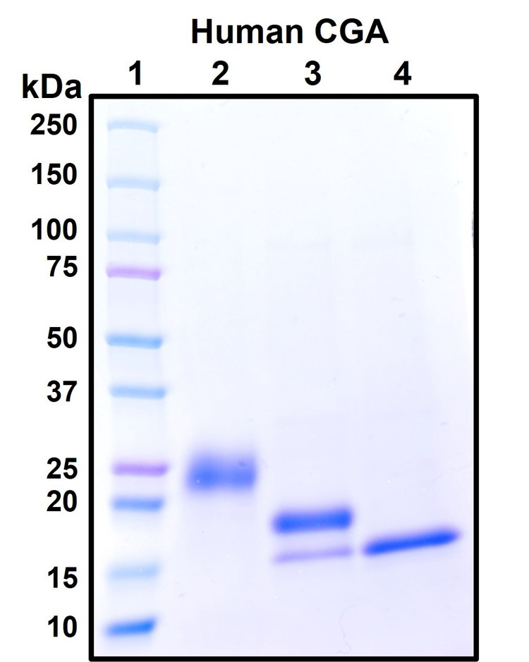 Figure 1. Deglycosylation analysis of purified recombinant proteins. Lane 1, protein ladder (kDa). Lane 2, glycosylated protein (delivered to customers). Lanes 3 and 4, deglycosylated proteins under native and denature conditions respectively.
