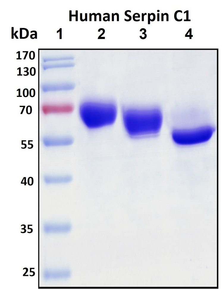Recombinant Human Anti-thrombin III (Serpin C1) Protein, Biotinylated
