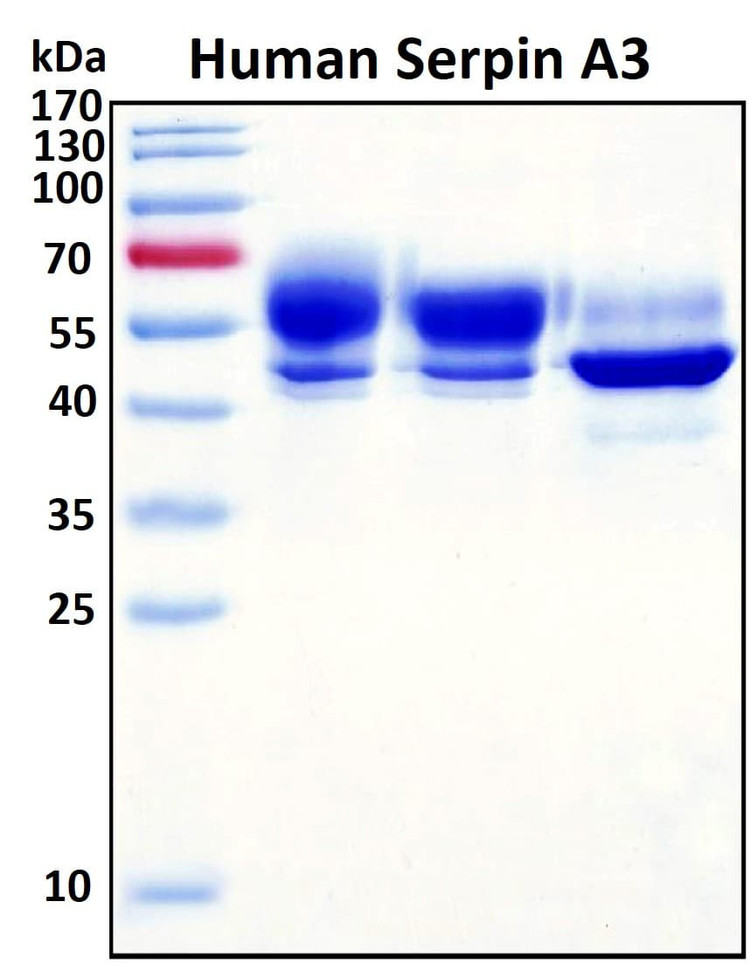 Recombinant Human Serpin A3 Protein, Biotinylated