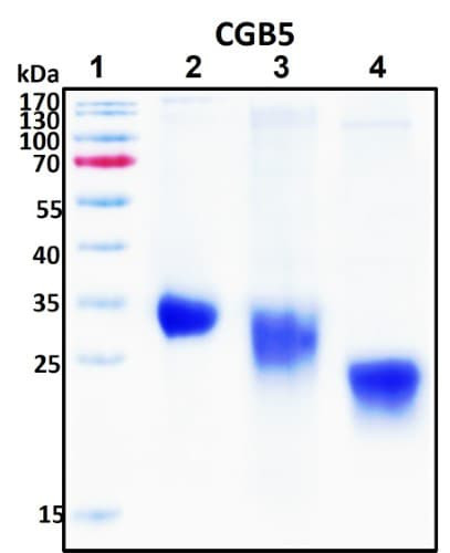 Recombinant Human Choriogonadotropin Subunit Beta 3 (CG-Beta), HEK293, Biotinylated