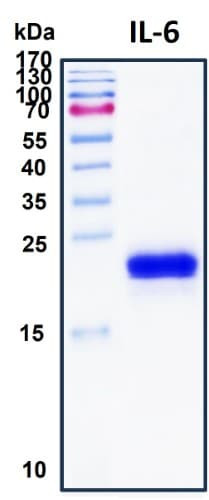Recombinant Human IL-6 Protein, HEK293, Biotinylated