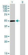 Anti-ERCC6L Antibody