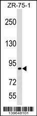 Anti-RASA3 (C-term) Antibody