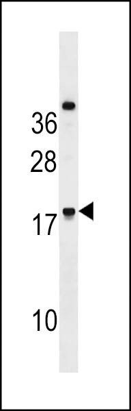 Anti-RNF224 (Center) Antibody