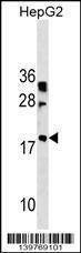Anti-LBX2 (Center) Antibody