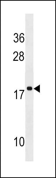 Anti-RPS17L (Center) Antibody