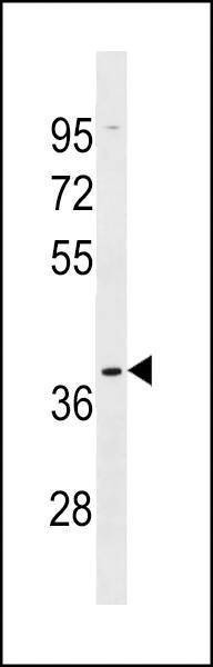 Anti-OR5AK2 (C-term) Antibody