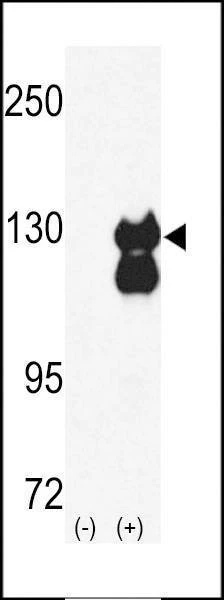 Anti-RENT1 (N-term E22) Antibody