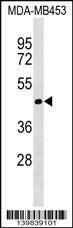 Anti-TIMM50 (N-term) Antibody