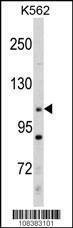 Anti-MLLT10 (AF10) (Center) Antibody