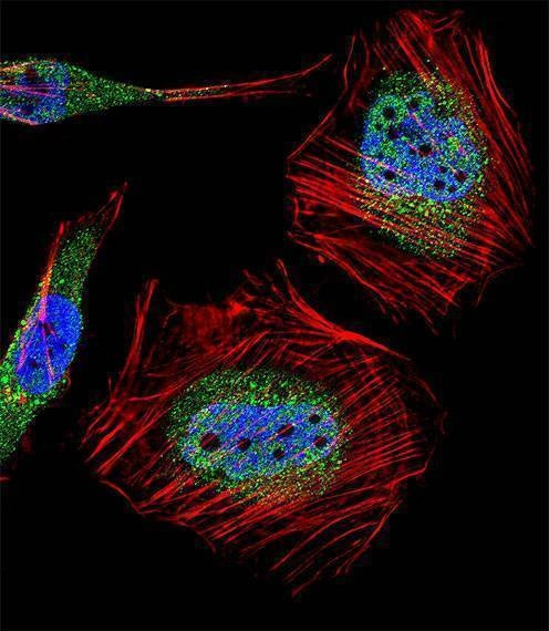 Anti-MLLT10 (AF10) (Center) Antibody