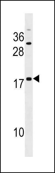 Anti-SPANXE (Center) Antibody