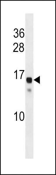 Anti-SSX11 (N-term) Antibody