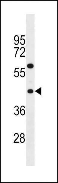 Anti-TAS2R3 (C-term) Antibody