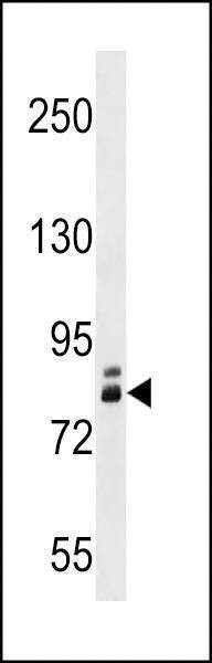 Anti-ZNF252 (N-term) Antibody
