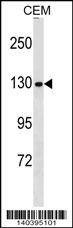 Anti-NCAPG (N-term) Antibody