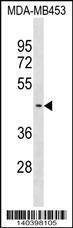 Anti-SUV39H2 (C-term) Antibody