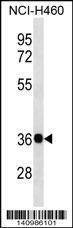 Anti-GNB4 (Center) Antibody