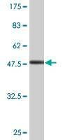 Anti-EXOSC1 Antibody