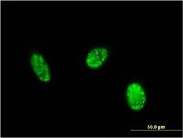 Anti-EXOSC1 Antibody