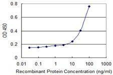 Anti-EXOSC1 Antibody