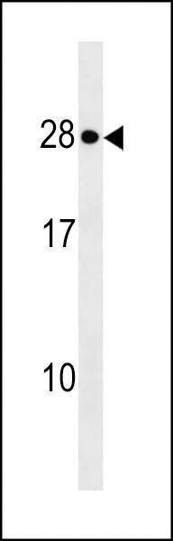 Anti-KDELR1 (C-term) Antibody