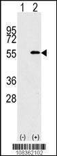 Anti-NUP50 (C-term) Antibody