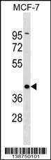 Anti-DMRT1 (C-term) Antibody