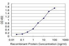 Anti-EXOSC2 Antibody