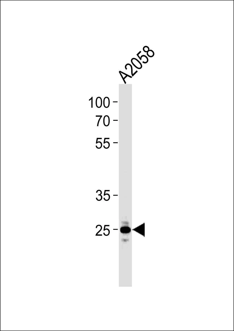 Anti-MRPL28 (N-term) Antibody