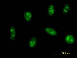 Anti-EXOSC5 Antibody