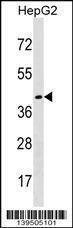 Anti-DHH (Center) Antibody