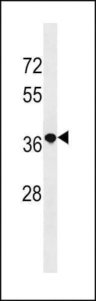 Anti-RN3L1 (C-term) Antibody