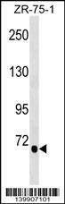 Anti-TGM5 (C-term) Antibody