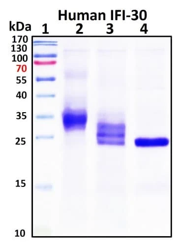Recombinant Human IFI30 (IP-30) Protein