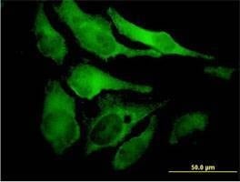 Anti-EYA2 Antibody