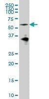 Anti-EYA2 Antibody