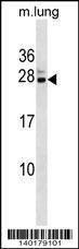 Anti-Mouse Cbx5 (C-term) Antibody