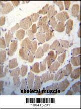 Anti-RUVBL1 (TIP49) (Center) Antibody