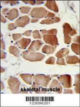 Anti-RUVBL1 Antibody