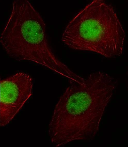 Anti-PGR/PR (C-term) Antibody